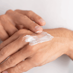 Abszesse, Aloe Vera, antiseptisch, beruhigt, biologisch, Bioqualität, Boswellia-Säure, Cannabidiol, CATALEYA, Cbd, CBD ÖL, Ekzeme, entzündungshemmend, Entzündungslindernd, Fette, Flavonoide, Gereizt, GESICHT, Gesichtscreme, Hanfpflanze, Hanfsamenöl, Haut, Hautbild, Hautirritation, Hautproblem, Hanfkosmetik, Hautverträglichkeit, Herpes, Hochwertig, Inhaltsstoffe, intensiv, Isolate, Körper, Körpercreme, Kosmetik, Kosmetiklinie, Kühlend, Nachhaltigkeit, Narbenbildung, Hanf, Neurodermitis, Nutzhanf, Öl, Österreich, Pflanzenöle, Pflanzenstoffe, pflanzlich, Pflegecreme, pflegt, Pickel, Regeneration, Regulierend, Säureschutzmantel, Schmerzlindernd, Schuppenflechte, Spektrum, Talgdrüse, Unterstützung, Vitamin E, vollspektrum, Weihrauch, Wunden, Narben, Akne, Pickel, Aloe Vera Gel, Biokosmetik, veganekosmetik, Creme, Salbe, Wundcreme, Heilpflanzen, Männer, Bart, Rasieren,