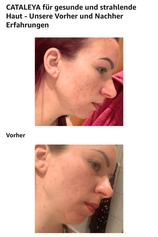Bewertung, Bewertungen, Erfahrung, Erfahrungen, Feedback, Wirkung, CBD, Hanf, Cannabidiol, Öl, Hanfcreme, Hanfkosmetik, Unreine Haut, CBD Öl Einnahme, Einnahme, Schlafprobleme, Schmerzen, Kopfschmerzen, Migräne, Krebserkrannkungen, Krebscbd, Krebsdiagnose, Tumor, Zellen, Akne, Mitesser, Pickel, Narben, Darmgesundheit, Collagen, Kollagen,