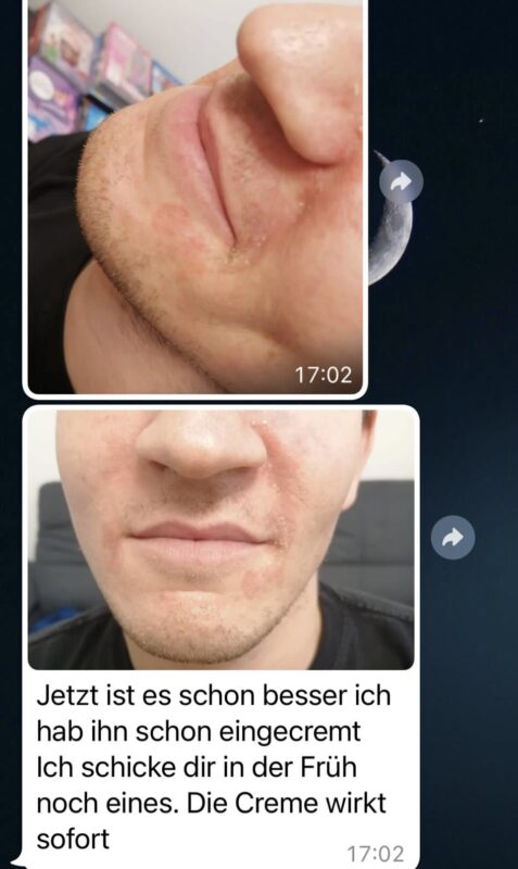 Bewertung, Bewertungen, Erfahrung, Erfahrungen, Feedback, Wirkung, CBD, Hanf, Cannabidiol, Öl, Hanfcreme, Hanfkosmetik, Unreine Haut, CBD Öl Einnahme, Einnahme, Schlafprobleme, Schmerzen, Kopfschmerzen, Migräne, Krebserkrannkungen, Krebscbd, Krebsdiagnose, Tumor, Zellen, Akne, Mitesser, Pickel, Narben, Darmgesundheit, Collagen, Kollagen,
