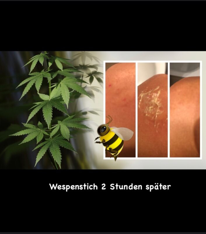 Bewertung, Bewertungen, Erfahrung, Erfahrungen, Feedback, Wirkung, CBD, Hanf, Cannabidiol, Öl, Hanfcreme, Hanfkosmetik, Unreine Haut, CBD Öl Einnahme, Einnahme, Schlafprobleme, Schmerzen, Kopfschmerzen, Migräne, Krebserkrannkungen, Krebscbd, Krebsdiagnose, Tumor, Zellen, Akne, Mitesser, Pickel, Narben, Darmgesundheit, Collagen, Kollagen,