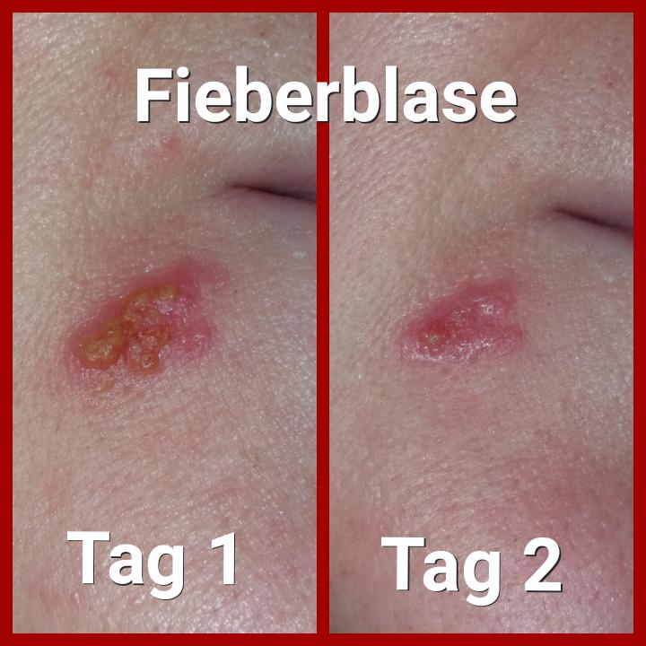 Bewertung, Bewertungen, Erfahrung, Erfahrungen, Feedback, Wirkung, CBD, Hanf, Cannabidiol, Öl, Hanfcreme, Hanfkosmetik, Unreine Haut, CBD Öl Einnahme, Einnahme, Schlafprobleme, Schmerzen, Kopfschmerzen, Migräne, Krebserkrannkungen, Krebscbd, Krebsdiagnose, Tumor, Zellen, Akne, Mitesser, Pickel, Narben, Darmgesundheit, Collagen, Kollagen, Fieberblase,