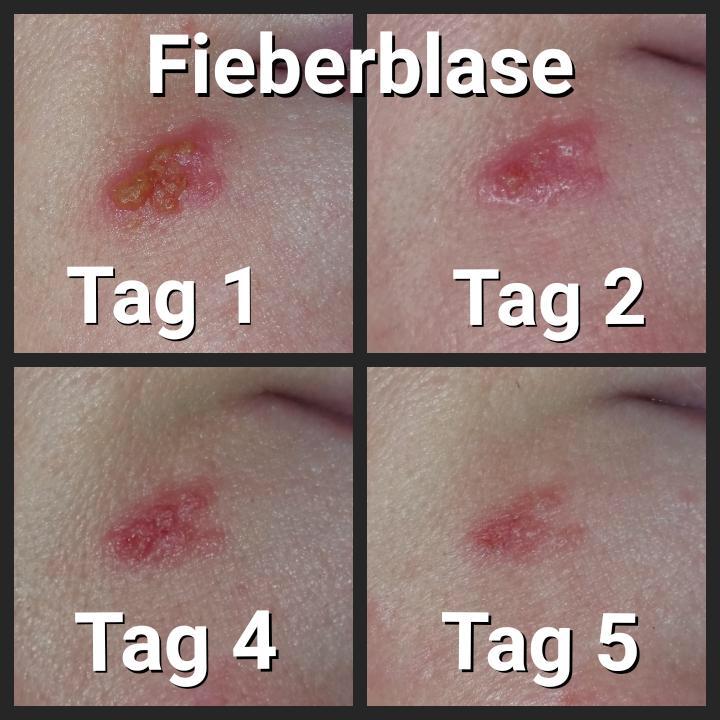 Bewertung, Bewertungen, Erfahrung, Erfahrungen, Feedback, Wirkung, CBD, Hanf, Cannabidiol, Öl, Hanfcreme, Hanfkosmetik, Unreine Haut, CBD Öl Einnahme, Einnahme, Schlafprobleme, Schmerzen, Kopfschmerzen, Migräne, Krebserkrannkungen, Krebscbd, Krebsdiagnose, Tumor, Zellen, Akne, Mitesser, Pickel, Narben, Darmgesundheit, Collagen, Kollagen,