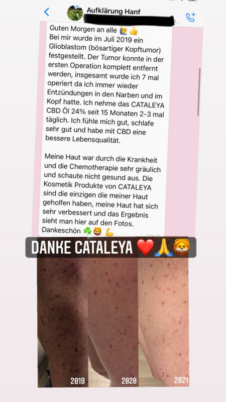 Bewertung, Bewertungen, Erfahrung, Erfahrungen, Feedback, Wirkung, CBD, Hanf, Cannabidiol, Öl, Hanfcreme, Hanfkosmetik, Unreine Haut, CBD Öl Einnahme, Einnahme, Schlafprobleme, Schmerzen, Kopfschmerzen, Migräne, Krebserkrannkungen, Krebscbd, Krebsdiagnose, Tumor, Zellen, Akne, Mitesser, Pickel, Narben, Darmgesundheit, Collagen, Kollagen,